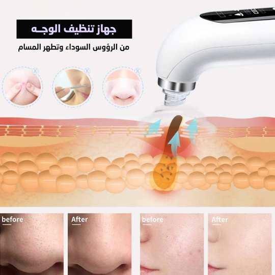 جهاز تنظيف الوجه من الرؤوس السوداء وتطهر المسام - Makfool