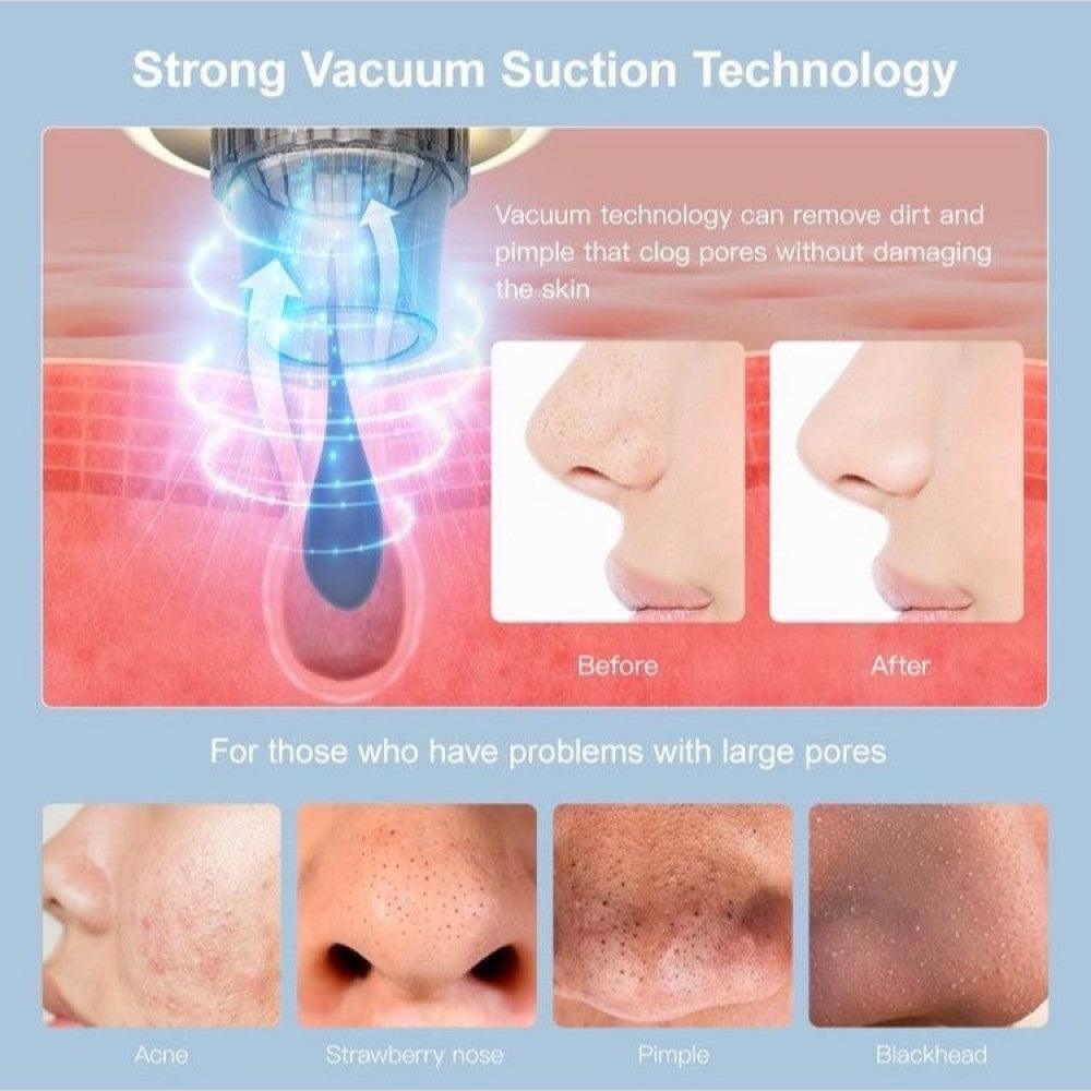 جهاز الهيدرافيشل المنزلي ذو التنظيف العميق - Makfool