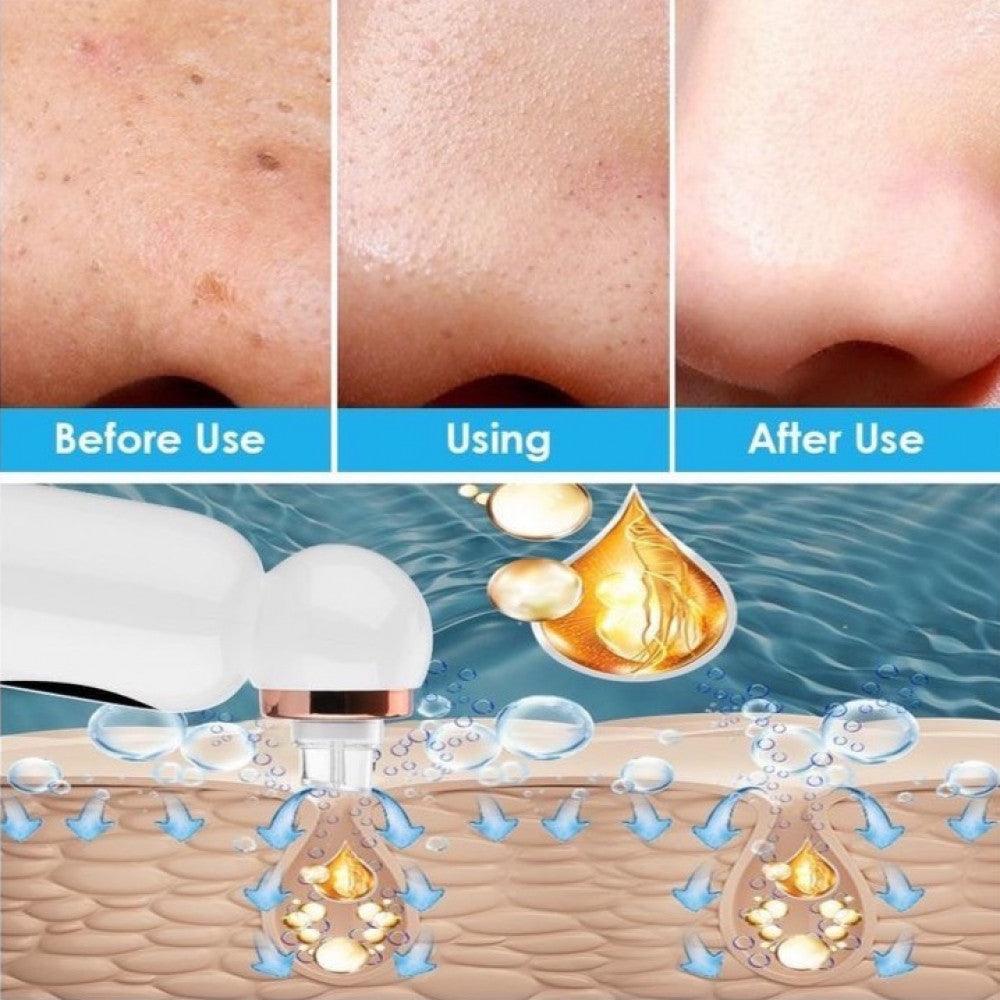 جهاز الهيدرافيشل المنزلي ذو التنظيف العميق - Makfool