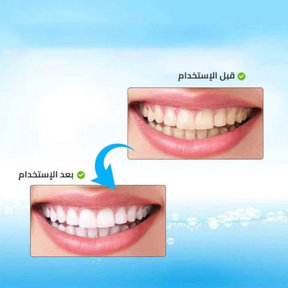 قلم تبييض الأسنان ٢٠٢٣- قطعتين - Makfool